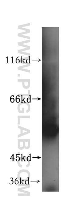 ATPB Rabbit anti-Human, Mouse, Rat, Polyclonal, Proteintech:Antibodies:Primary