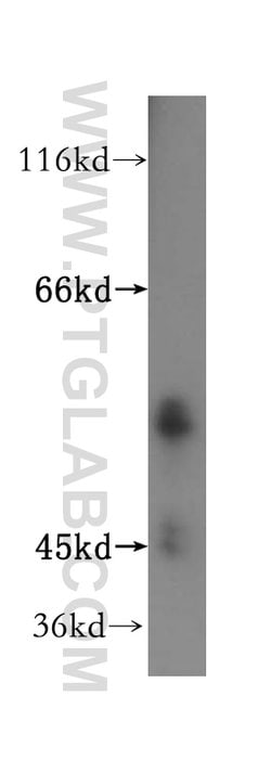 ATPB Rabbit anti-Human, Mouse, Rat, Polyclonal, Proteintech:Antibodies:Primary