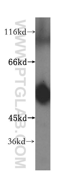 ATPB Rabbit anti-Human, Mouse, Rat, Polyclonal, Proteintech:Antibodies:Primary