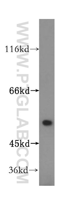 ATPB Rabbit anti-Human, Mouse, Rat, Polyclonal, Proteintech:Antibodies:Primary