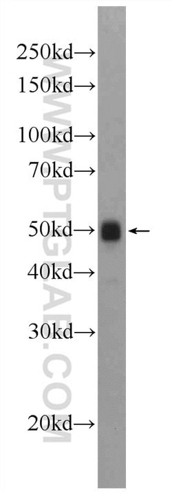ATPB Rabbit anti-Human, Mouse, Rat, Polyclonal, Proteintech:Antibodies:Primary