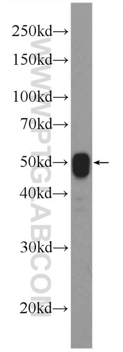 ATPB Rabbit anti-Human, Mouse, Rat, Polyclonal, Proteintech:Antibodies:Primary