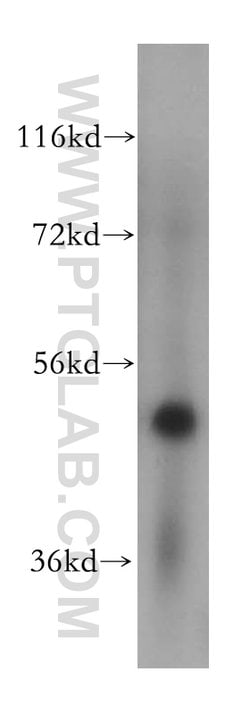 PUS3 Rabbit anti-Human, Mouse, Rat, Polyclonal, Proteintech:Antibodies:Primary
