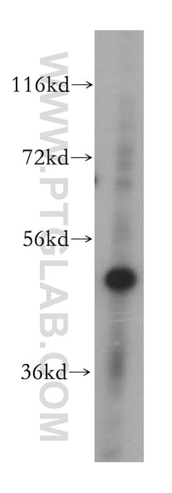 PUS3 Rabbit anti-Human, Mouse, Rat, Polyclonal, Proteintech:Antibodies:Primary