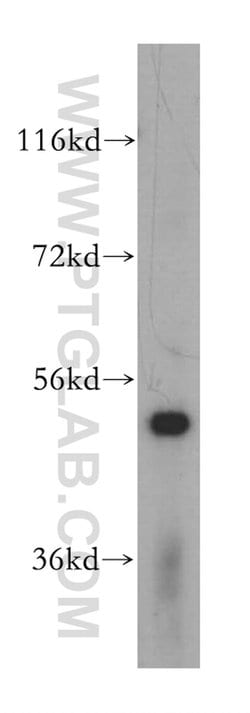 PUS3 Rabbit anti-Human, Mouse, Rat, Polyclonal, Proteintech:Antibodies:Primary