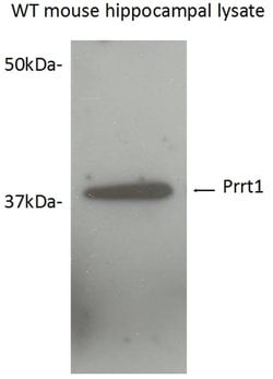 SynDIG4/PRRT1 Rabbit anti-Human, Mouse, Rat, Polyclonal, Proteintech 150