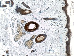 Cytokeratin 16 Rabbit anti-Human, Mouse, Rat, Polyclonal, Proteintech:Antibodies:Primary