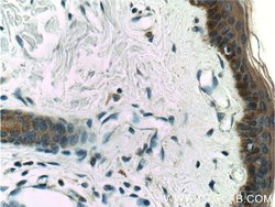 Cytokeratin 16 Rabbit anti-Human, Mouse, Rat, Polyclonal, Proteintech:Antibodies:Primary