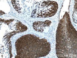 Cytokeratin 16 Rabbit anti-Human, Mouse, Rat, Polyclonal, Proteintech:Antibodies:Primary