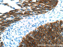 Cytokeratin 16 Rabbit anti-Human, Mouse, Rat, Polyclonal, Proteintech:Antibodies:Primary