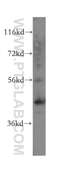 Cytokeratin 16 Rabbit anti-Human, Mouse, Rat, Polyclonal, Proteintech:Antibodies:Primary