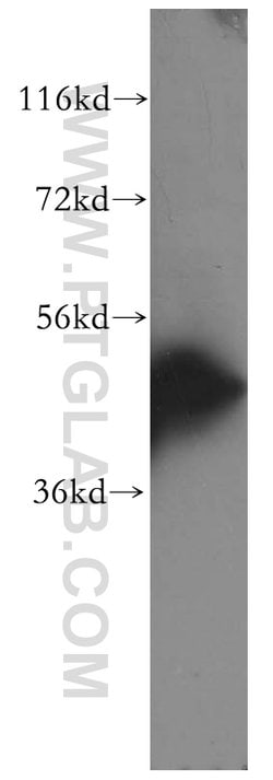 Cytokeratin 16 Rabbit anti-Human, Mouse, Rat, Polyclonal, Proteintech:Antibodies:Primary