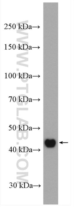 Cytokeratin 16 Rabbit anti-Human, Mouse, Rat, Polyclonal, Proteintech:Antibodies:Primary