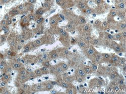 EFCAB1 Rabbit anti-Human, Polyclonal, Proteintech:Antibodies:Primary Antibodies