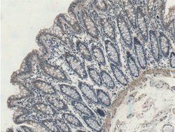 EFCAB1 Rabbit anti-Human, Polyclonal, Proteintech:Antibodies:Primary Antibodies