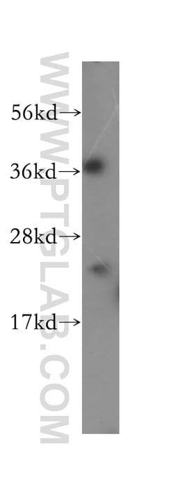 EIF4E3 Rabbit anti-Human, Mouse, Rat, Polyclonal, Proteintech 150 &mu;L;