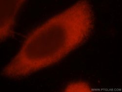 EIF4E3 Rabbit anti-Human, Mouse, Rat, Polyclonal, Proteintech 150 &mu;L;