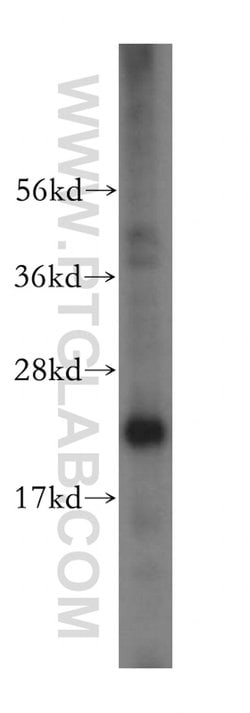 EIF4E3 Rabbit anti-Human, Mouse, Rat, Polyclonal, Proteintech 150 &mu;L;