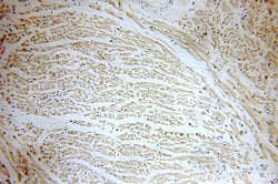 MYL7 Rabbit anti-Human, Mouse, Rat, Polyclonal, Proteintech:Antibodies:Primary