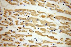MYL7 Rabbit anti-Human, Mouse, Rat, Polyclonal, Proteintech:Antibodies:Primary