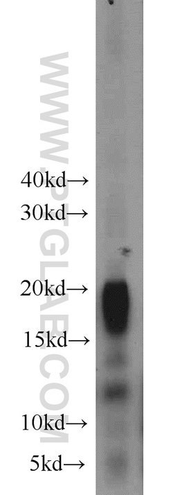 MYL7 Rabbit anti-Human, Mouse, Rat, Polyclonal, Proteintech:Antibodies:Primary