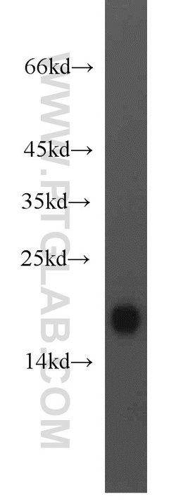 MYL7 Rabbit anti-Human, Mouse, Rat, Polyclonal, Proteintech:Antibodies:Primary