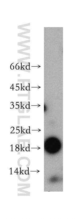 MYL7 Rabbit anti-Human, Mouse, Rat, Polyclonal, Proteintech:Antibodies:Primary