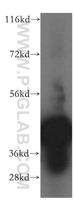 BXDC2 Rabbit anti-Human, Mouse, Rat, Polyclonal, Proteintech:Antibodies:Primary