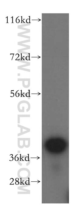 BXDC2 Rabbit anti-Human, Mouse, Rat, Polyclonal, Proteintech:Antibodies:Primary