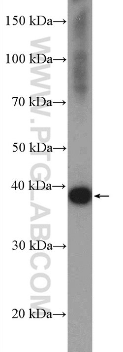 BXDC2 Rabbit anti-Human, Mouse, Rat, Polyclonal, Proteintech:Antibodies:Primary