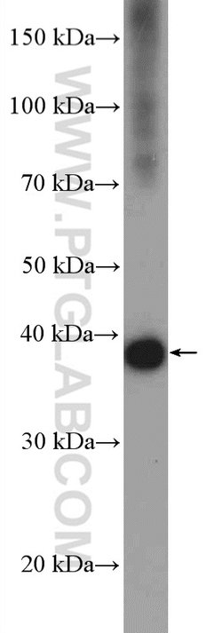 BXDC2 Rabbit anti-Human, Mouse, Rat, Polyclonal, Proteintech:Antibodies:Primary