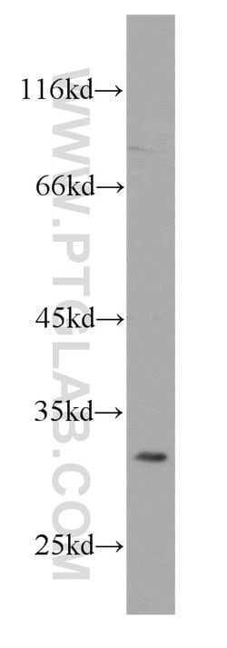 RPS4Y1 Rabbit anti-Human, Mouse, Rat, Polyclonal, Proteintech 150 &mu;L;