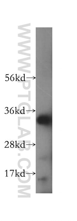 HSD17B11 Rabbit anti-Human, Mouse, Rat, Polyclonal, Proteintech:Antibodies:Primary