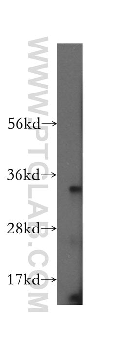 HSD17B11 Rabbit anti-Human, Mouse, Rat, Polyclonal, Proteintech:Antibodies:Primary