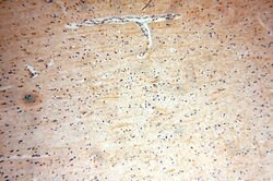 ENPP4 Rabbit anti-Human, Mouse, Rat, Polyclonal, Proteintech:Antibodies:Primary