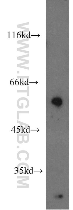 ENPP4 Rabbit anti-Human, Mouse, Rat, Polyclonal, Proteintech:Antibodies:Primary