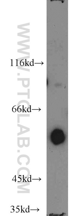 ENPP4 Rabbit anti-Human, Mouse, Rat, Polyclonal, Proteintech:Antibodies:Primary
