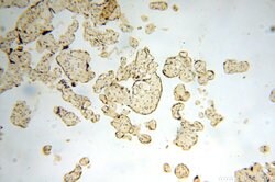 ERLIN1 Rabbit anti-Human, Mouse, Rat, Polyclonal, Proteintech:Antibodies:Primary