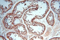 ERLIN1 Rabbit anti-Human, Mouse, Rat, Polyclonal, Proteintech:Antibodies:Primary
