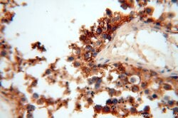 ERLIN1 Rabbit anti-Human, Mouse, Rat, Polyclonal, Proteintech:Antibodies:Primary