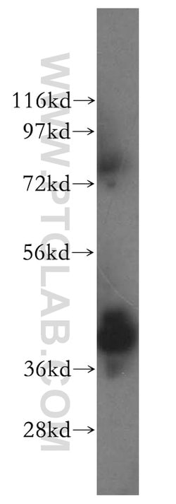 ERLIN1 Rabbit anti-Human, Mouse, Rat, Polyclonal, Proteintech:Antibodies:Primary