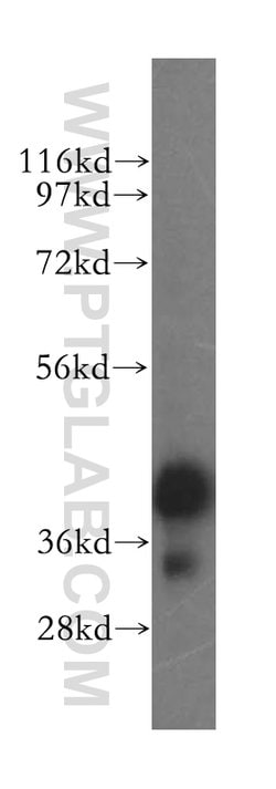 ERLIN1 Rabbit anti-Human, Mouse, Rat, Polyclonal, Proteintech:Antibodies:Primary