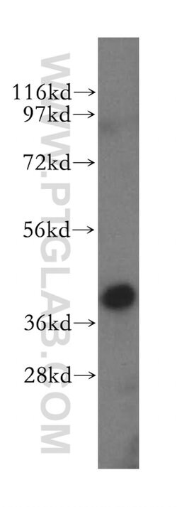 ERLIN1 Rabbit anti-Human, Mouse, Rat, Polyclonal, Proteintech:Antibodies:Primary
