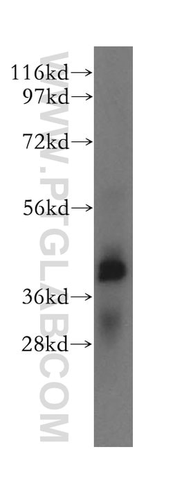 ERLIN1 Rabbit anti-Human, Mouse, Rat, Polyclonal, Proteintech:Antibodies:Primary