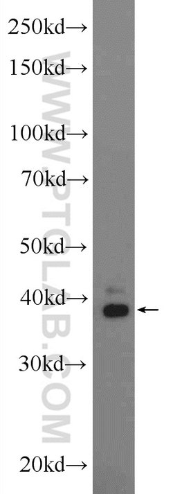 ERLIN1 Rabbit anti-Human, Mouse, Rat, Polyclonal, Proteintech:Antibodies:Primary