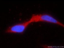 Proteintech Group Inc TRPV5 Rabbit anti-Human, Mouse, Rat, Polyclonal, Proteintech