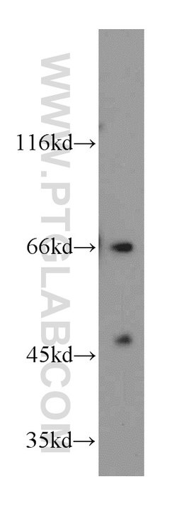 CD1a Rabbit anti-Human, Mouse, Polyclonal, Proteintech 150 &mu;L; Unconjugated:Antibodies,
