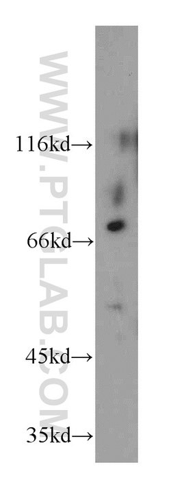CD1a Rabbit anti-Human, Mouse, Polyclonal, Proteintech 150 &mu;L; Unconjugated:Antibodies,
