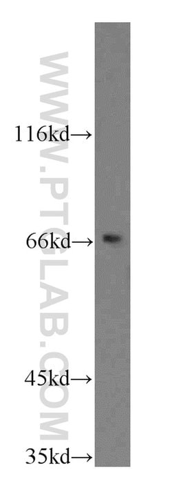 CD1a Rabbit anti-Human, Mouse, Polyclonal, Proteintech 150 &mu;L; Unconjugated:Antibodies,