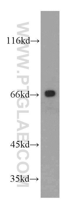 CD1a Rabbit anti-Human, Mouse, Polyclonal, Proteintech 150 &mu;L; Unconjugated:Antibodies,
